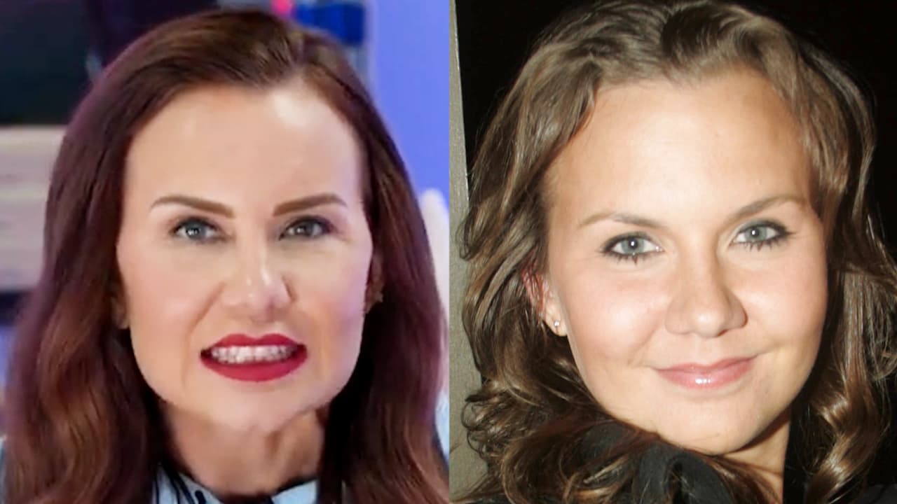 Michelle Vieth reacciona a críticas sobre su rostro y revela a qué se debe su apariencia
