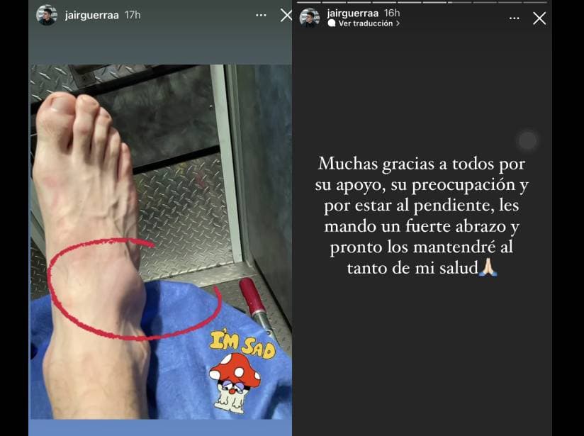Jair muestra su pie tras lesión en Guerrero 2021
