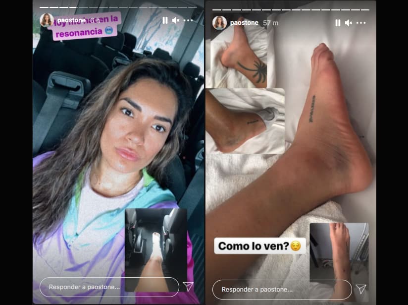 Paola muestra su pie tras lesión en Guerreros 2021