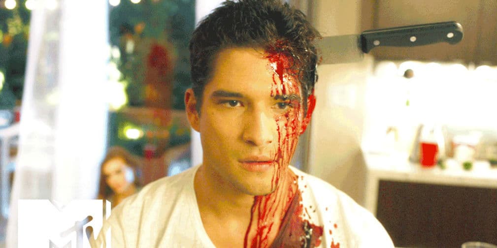 'Asesinan' brutalmente a Tyler Posey
