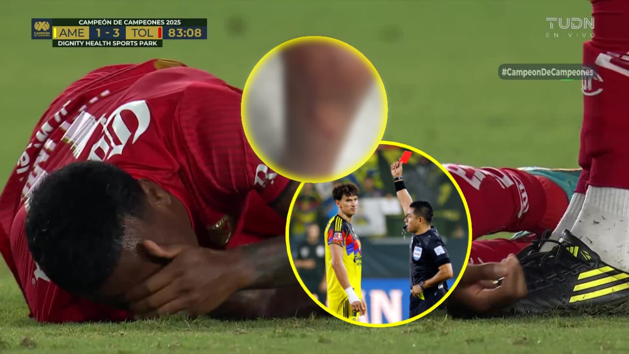 Helinho muestra su tremenda herida tras dura entrada de Lichnovsky