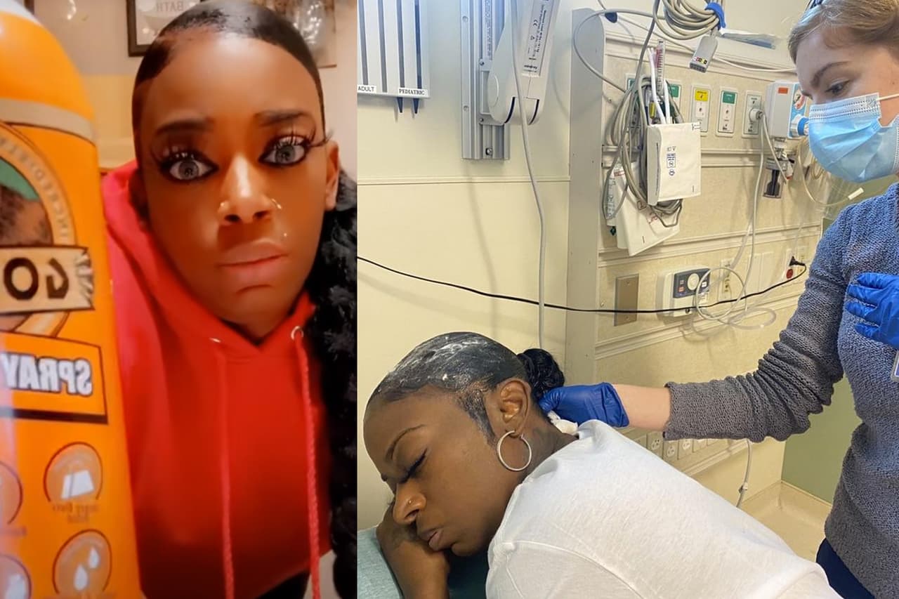 ¿A quién se le ocurre? Mujer se vuelve viral por usar pegamento industrial en su cabello