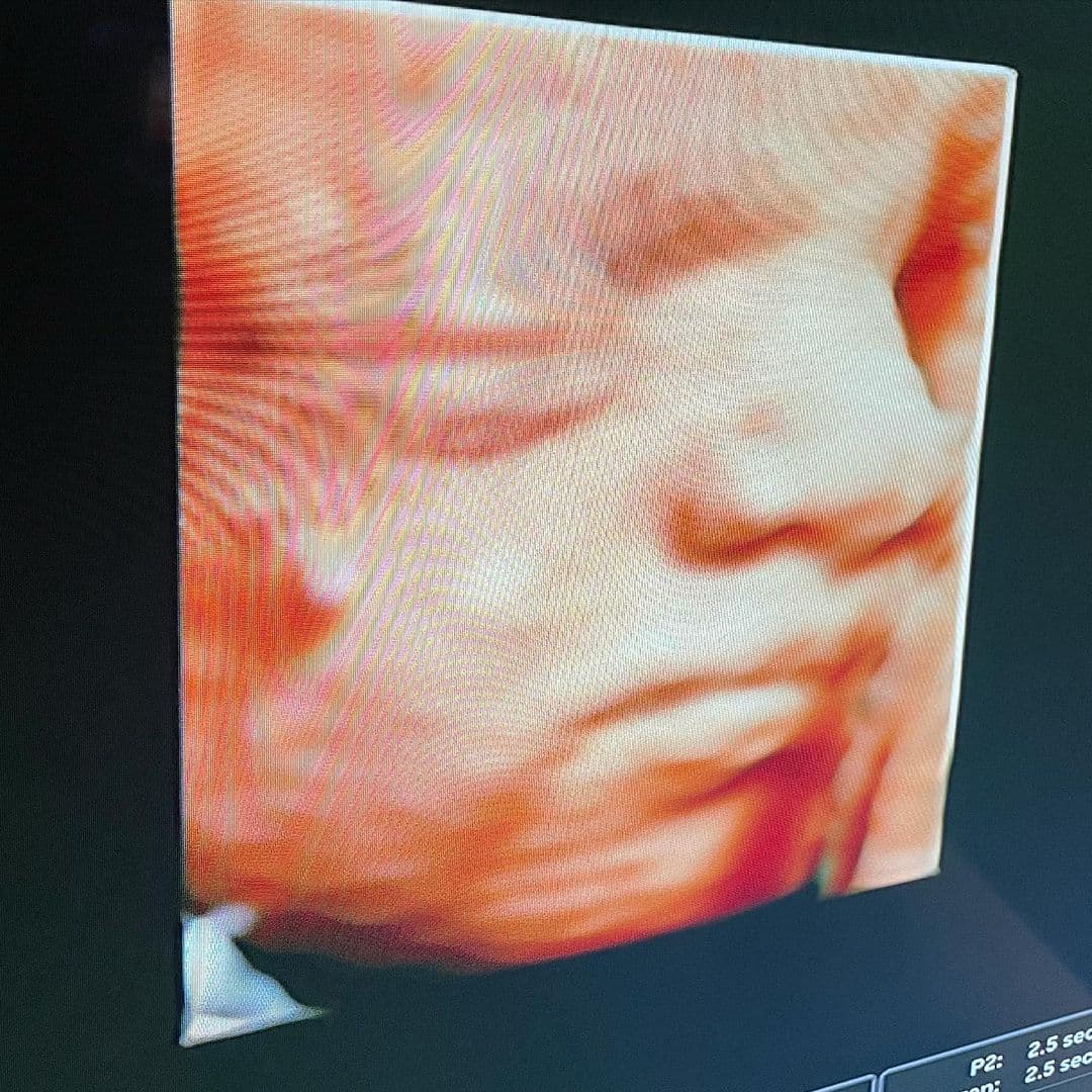 ¡Ya queremos conocer a Baby Leonel, quien nacerá entre la última semana de agosto y en la primera de septiembre!