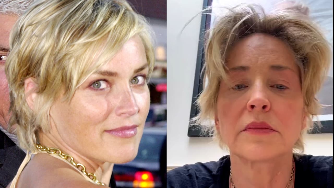 Sharon Stone perdió su carrera y su dinero tras sufrir una hemorragia cerebral