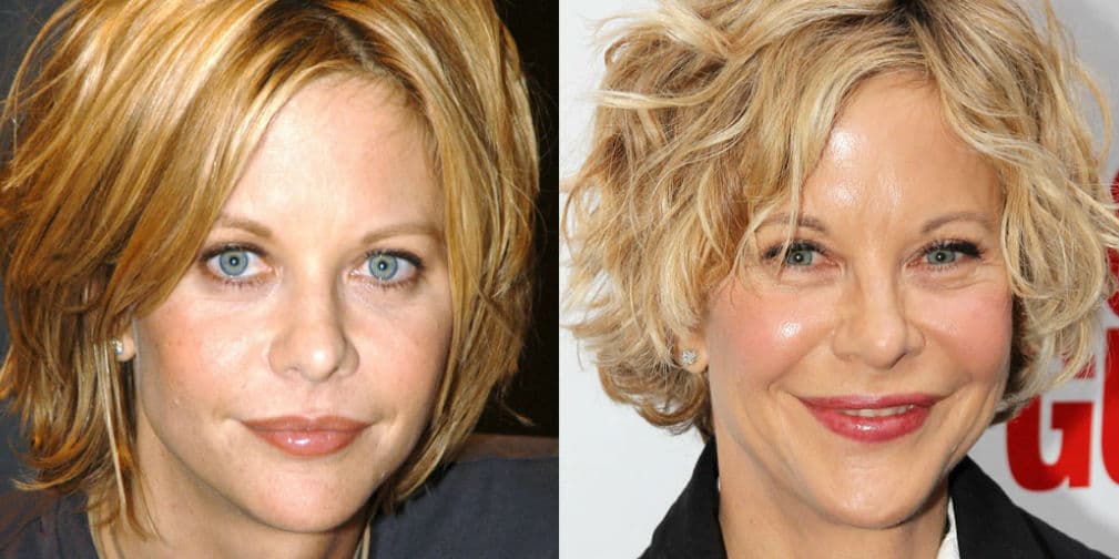 6. Meg Ryan: A los 53 años, la actriz tiene labios más finos, ojos rasgados y piel tersa, pero no se ve más joven.