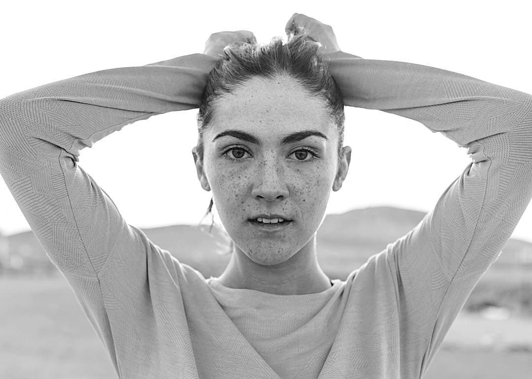 ¡Sus pecas son su rasgo físico más lindo!