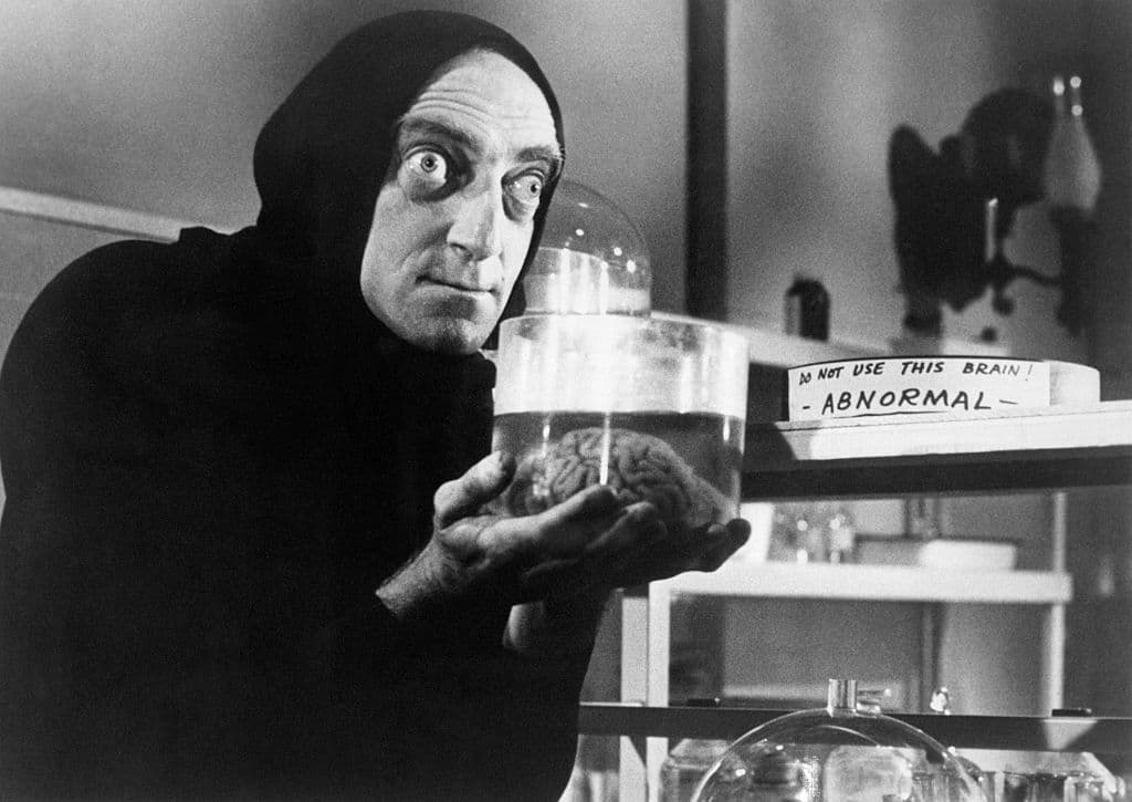Fue un actor prominente que debutó en 'The Bed Sitting Room' (1969) y es recordado por darle vida a Igor en "Young Frankenstein" (1974); ganó el Premio Saturno al Mejor Actor de Reparto por este último papel.