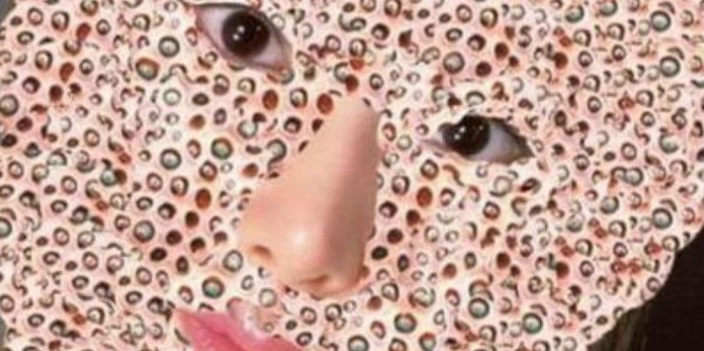 ¿Sigues con tripofobia? Descúbrelo con estas imágenes
