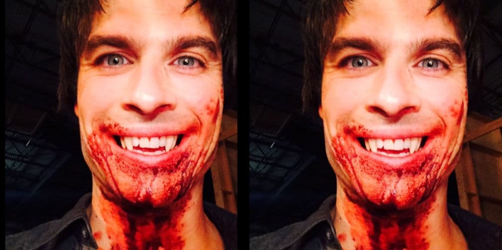 Ian Somerhalder presume sonrisa 'sangrienta'