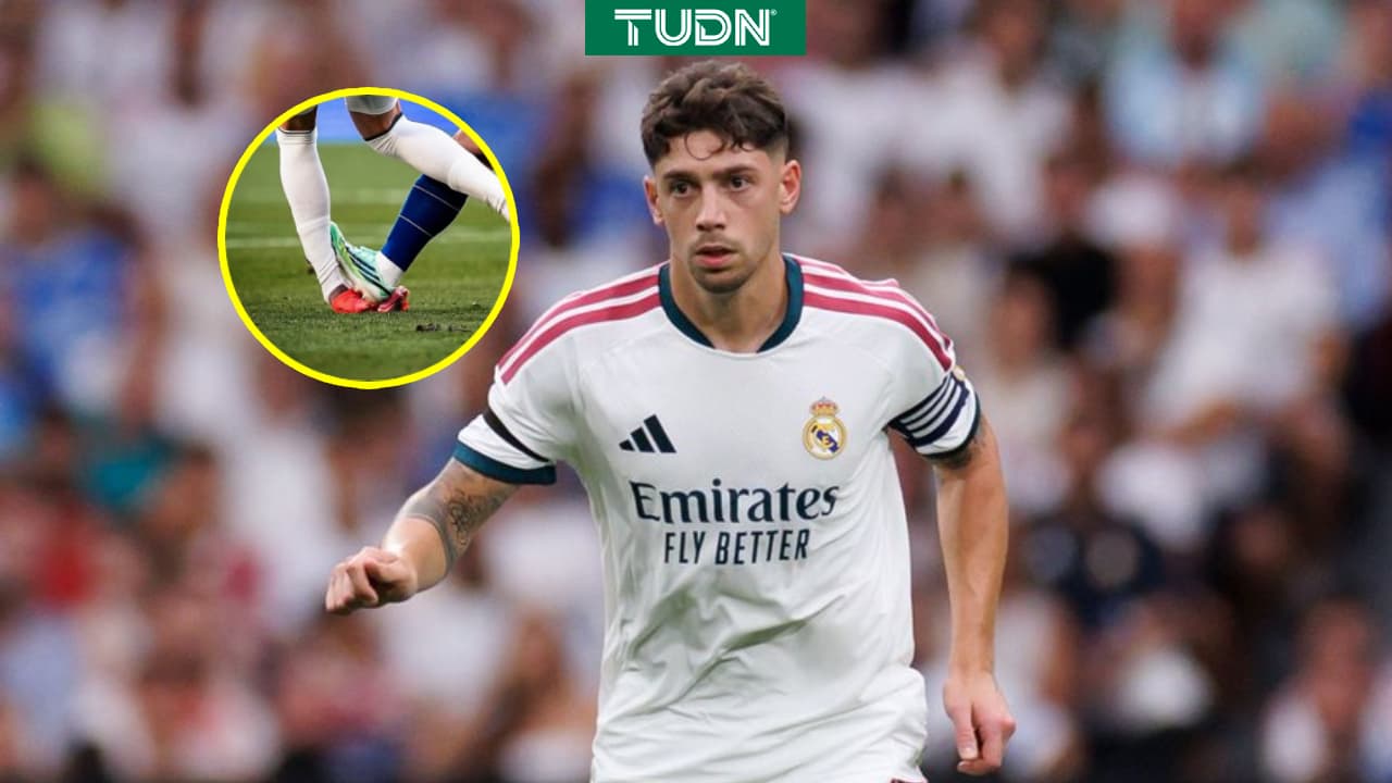 Real Madrid confirma lesión de Federico Valverde tras polémica entrada