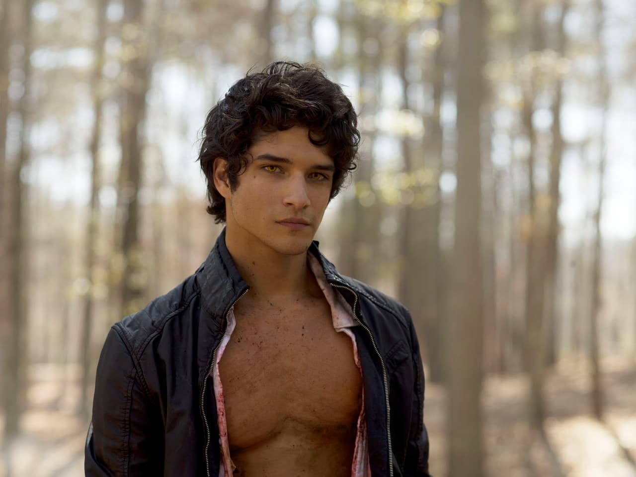 Teen Wolf, Episodio 1