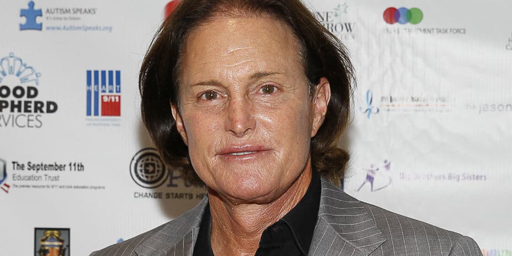 4. Bruce Jenner: Muchos critican su apariencia artificial, quizás ahora que se convierta en Caitlyn luzca mejor.