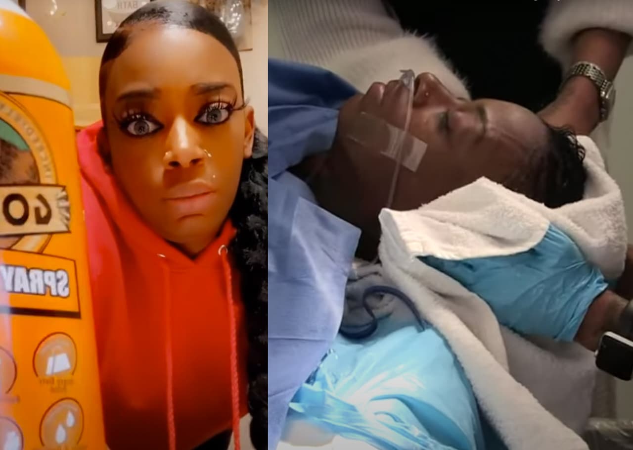 ¡Por fin! Mujer que usó pegamento industrial en su cabello se somete a cirugía para retirarlo
