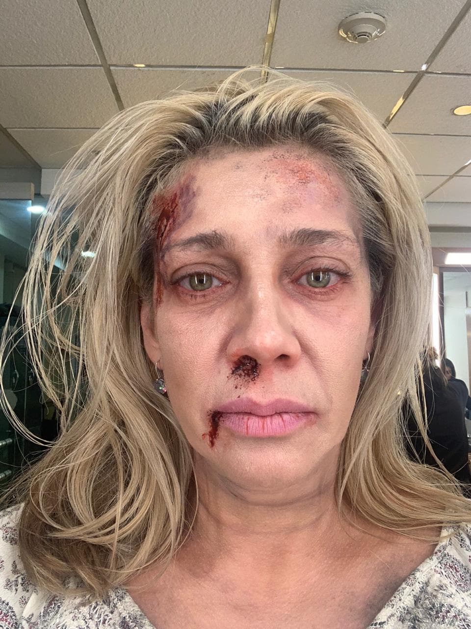 Cynthia Klitbo interpreta a una mujer indigente en Médicos Línea de vida