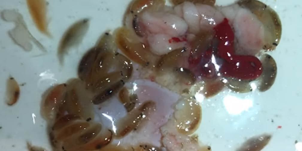 Cuidado con estos depredadores; ¡podrían comerte la piel en el mar!