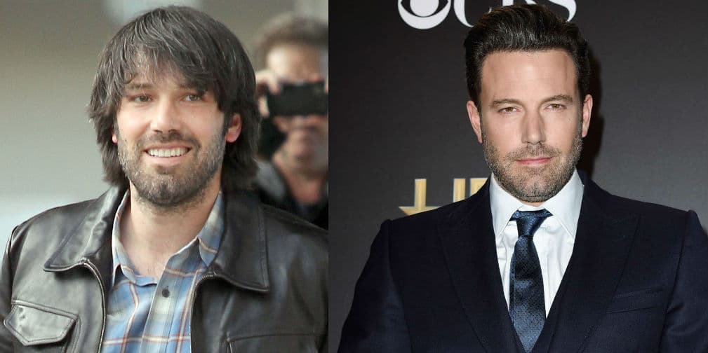 3. Ben Affleck: Dicen que el nuevo Batman se levantó los pómulos, las cejas, y se operó la nariz. ¿Será?