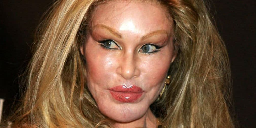3. Jocelyn Wildenstein: Esta millonaria se habría gastado más de 4 millones de dólares en 30 cirugías estéticas para parecerse a un gato.