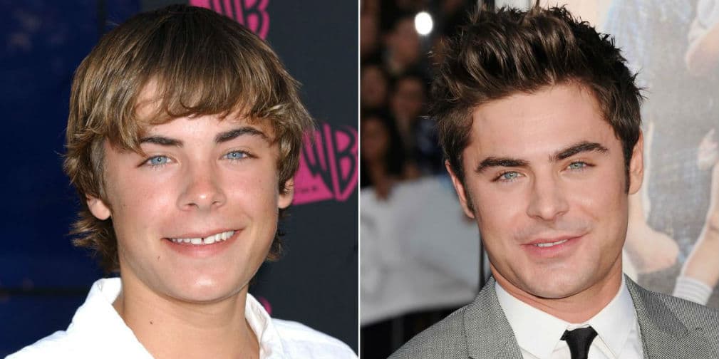 13. Zac Efron (18 de octubre de 1987) - Adiós quedó el niño de dientes saltones, en su lugar quedó el galán de Hollywood. De High Scholl Musical a interpretar al asesino serial Ted Bundy.