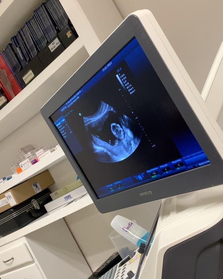 También compartió un ultrasonido en video, pero comentó que no se dejó ver si era niño o niña.