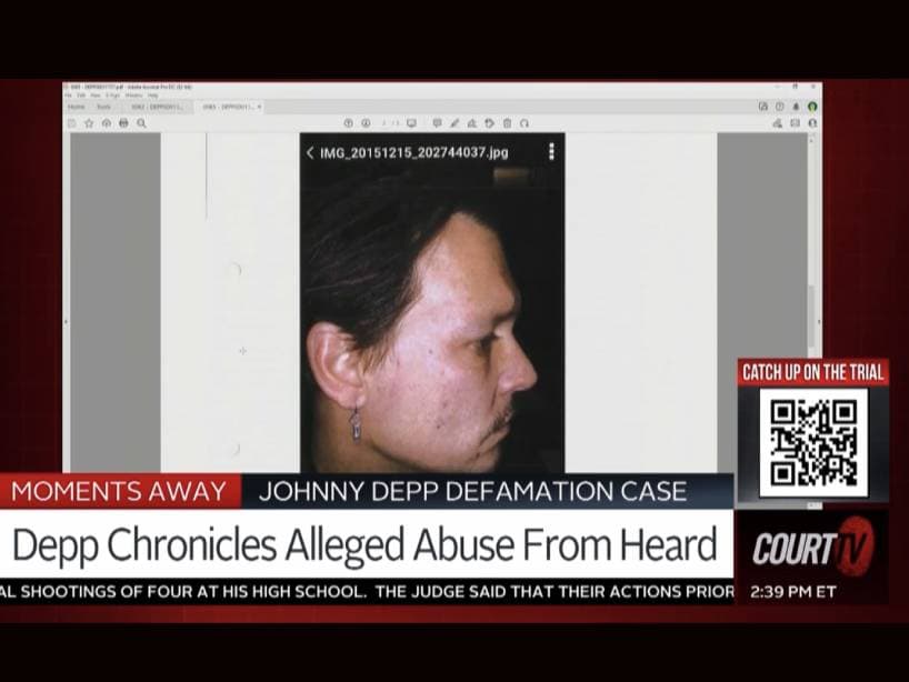 La defensa de Johnny Depp prsentó como evidencia diversas imágenes del actor tras las agreciones de su exesposa.