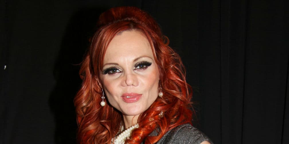 Esta modelo y actriz sacrificó su belleza por la fama... ¿o el que juega con el demonio quemado termina?